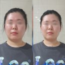 구암로49길 | 대구 칠곡 웨딩관리 작은얼굴 바른몸매 안면비대칭 두골비 관리 후기