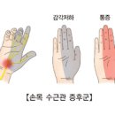 왼쪽 오른쪽 손목통증 원인 증상 해결방법 이미지