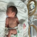 한나가스 | 전주예수병원 34주 1일 차 응급 제왕절개 후기 3박 4일 비용