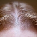 머리좀hair 네이버블로그