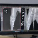 이태원동물병원 | 강아지 십자인대 파열 TPLO 수술 가격 후기 [강남 24시 동물병원 래이동물의료센터]