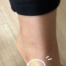 힘나는병원 | 아이 축구 다리 통증, 양산 힘나는병원에서 물리치료 받고 온 솔직 후기