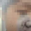 전치 앞(2) 이미지