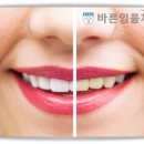 여치과기공소 이미지