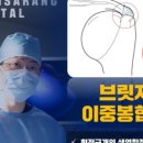 바른사랑병원 네이버블로그