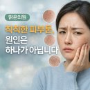 최윤정피부과의원 네이버블로그
