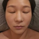온숨에스테틱 | 신사피부관리 제대로 받고 온 만족 후기 압구정에스테틱 디토뷰티샵
