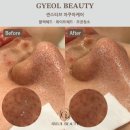 인계동피부관리잘하는곳 더워지기 전에 관리시작!