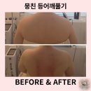가오스 | 뭉친 등어깨풀기는 다사피부관리샵 라피움에스테틱, 한 번 받았을 뿐인데!