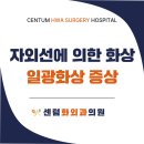 센텀화상외과 뜨거운 태양! 자외선에 의한 화상 '일광화상' 증상은?