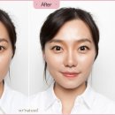 이선 헤어라인