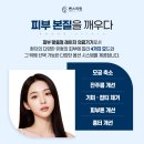 클리어레이저