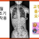 우리메디칼보조기 이미지
