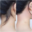 용산-353 | 🧔‍♀️털친자가 추천하는 슈가링 왁싱 전문샵 코멜리🍯 :: 뒷목 왁싱 후기, 용산 이태원 뒷목 왁싱샵 추천
