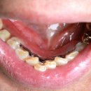 프레임치과기공소 이미지