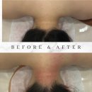 결혼 전 꼭 필요한 윤곽&amp;웨딩 피부관리 양산 증산 “토탈뷰티 봄”방문 후기