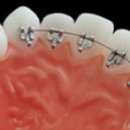 새로치과기공소 이미지