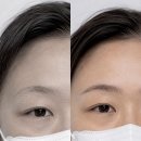 영구비어 | 노온사동눈썹반영구 상담후기, 듬성듬성 비어 보이는 눈썹이 고민이었던 40대눈썹문신 이야기