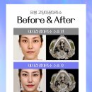 더좋은성형외과의원 이미지