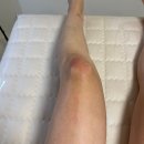 소온 | 대구 황금동 왁싱 수성구 바디관리 소온 후기