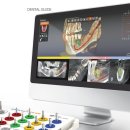 이플러스치과기공소 이미지