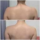 하님약국 | [여주체형관리샵] &#39;메디스킨 유리하&#39; 더조각에너지테라피+테라노바 체형교정 관리 솔직후기