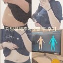 11545-07-23-08 | 복부지방분해주사후기 5회차 후 2개월, 아랫배 라인 유지와 종류 알려주는 솔직후기