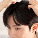 촘촘 스칼프 이미지