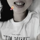 치아교정 얼굴변화 비용 소요기간 토끼이빨 돌출입 무턱 전후비교 수원교정치과 화이트바른이치과