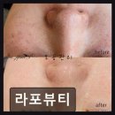 라포체형관리