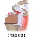 서정형외과 네이버블로그