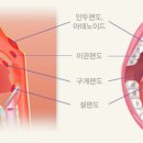 쓸모없는 줄 알고 잘라냈던 ‘편도·아데노이드’의 재발견 이미지