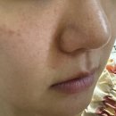 피부과 대신 홈케어! 뷰티영 큐어샷 아쿠아필 모공디바이스 사용후기