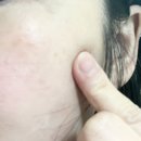 알파안경 | 피부과 대란템 기미 크림인 이앤코스 알부틴(2%) 알파 크림으로 기미도 잡고 칙칙한 피부도 화사하게~