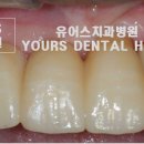 유어스치과병원 네이버블로그
