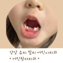 상암 치과 주말 유치발치 어린왕자치과 방문후기