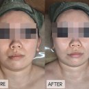 라인앤클루 | 킴그린스킨앤바디 스노우테라피 3D 리프팅 관리 받은 후기