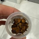 재원메디컬의원 | 부천 담석 수술 실제 후기 – 담낭 제거 수술 사례와 비용공개(단일공 복강경)