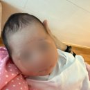 3077 | 한헬스케어 하니헬멧 두상교정 -1 -추천인코드 솔직한 후기