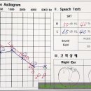 포낙보청기 남포센터 이미지