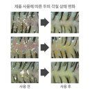 두피케어 강남피부과샴푸 블루밍셀 리페어샴푸 후기