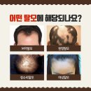 도척경희한의원 | 경기광주탈모한의원, 남다른 노하우를 통해!