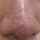 진성레이져 이미지