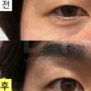 모즈의원 네이버블로그