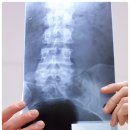 3H(에이치) 지압침대 이미지