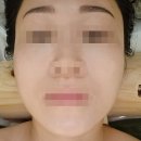 미고 테라피 이미지