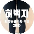 공주사 | 허벅지지방분해주사 2회차 효과및 내돈내산 후기