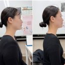 플라베스 네이버블로그