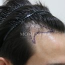 모먼트의원 이미지