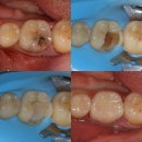 청담세브란스치과의원 이미지